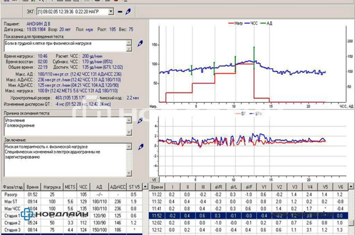 Велоэргометрический комплекс на базе электрокардиографа