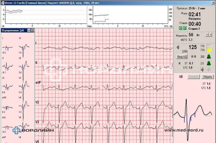 Велоэргометрический комплекс на базе электрокардиографа